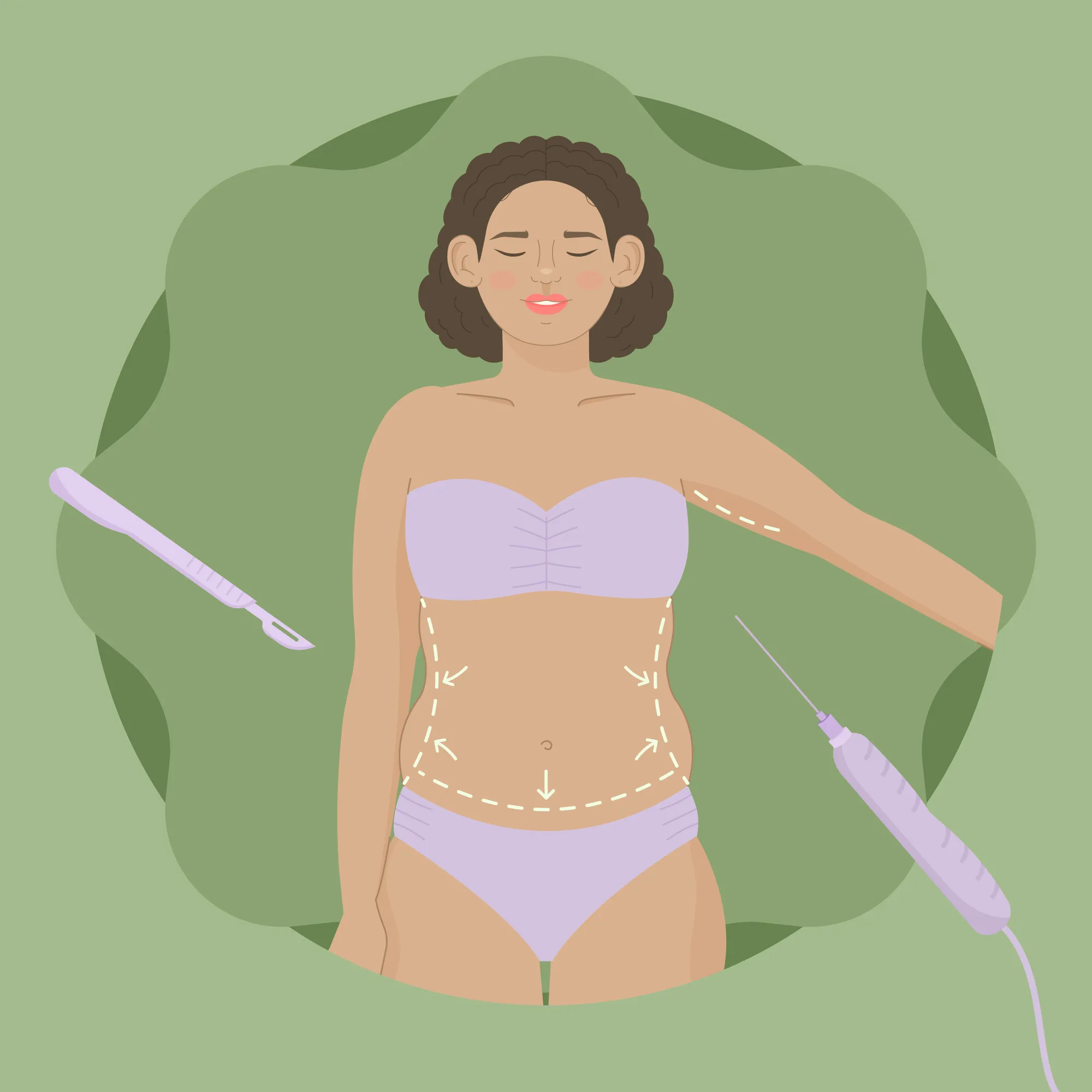 Liposuction