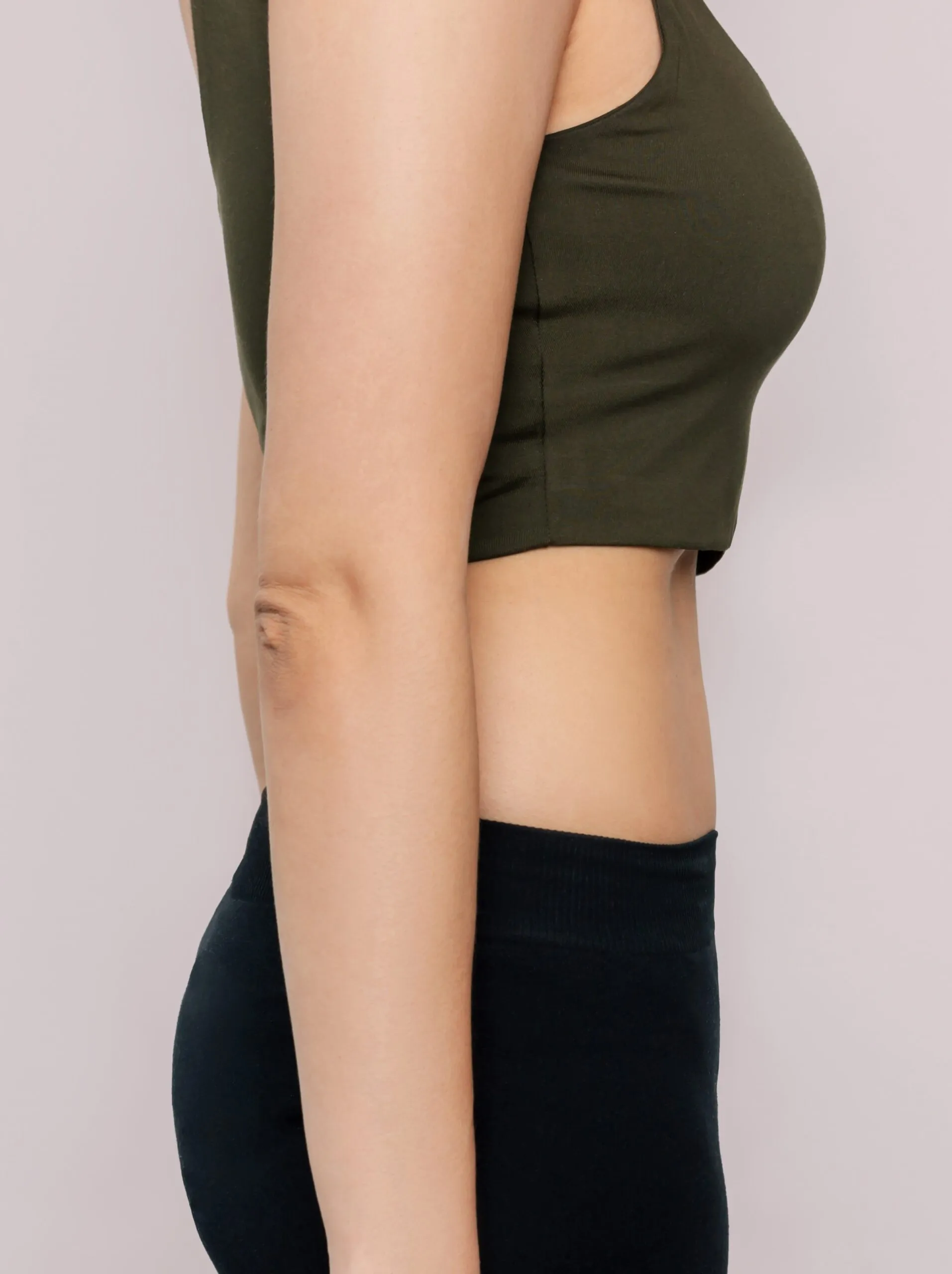 After Weight Loss