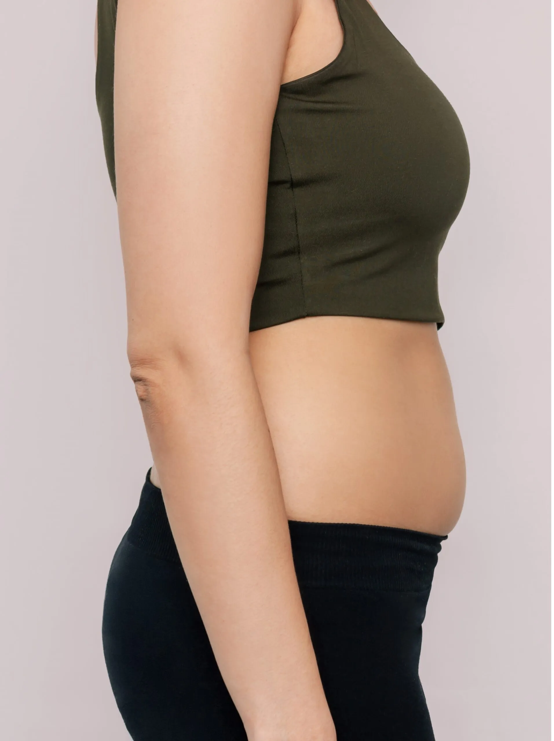Before Weight Loss