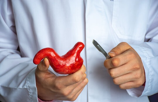 Best Bariatric Surgery in Islamabad