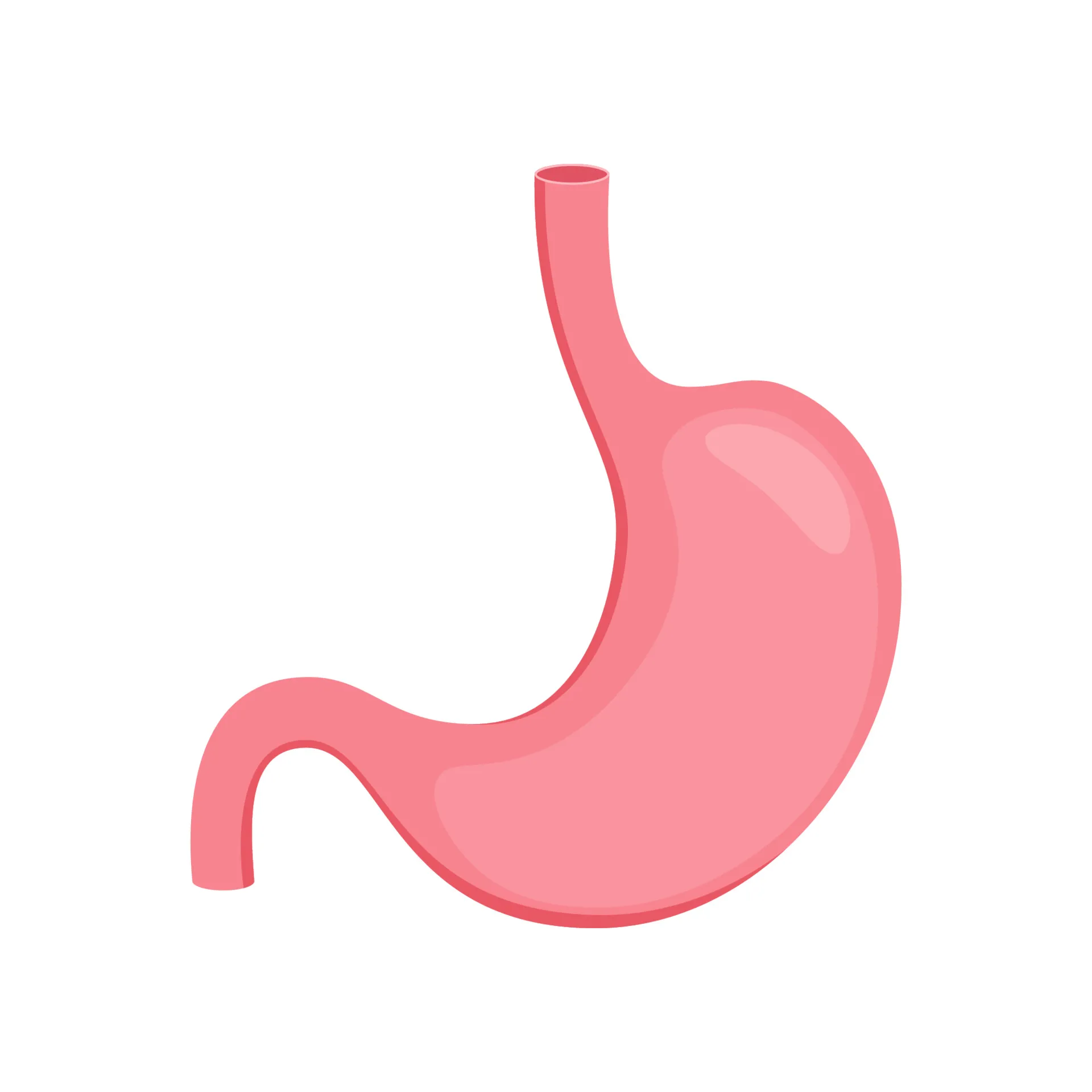 Sleeve Gastrectomy