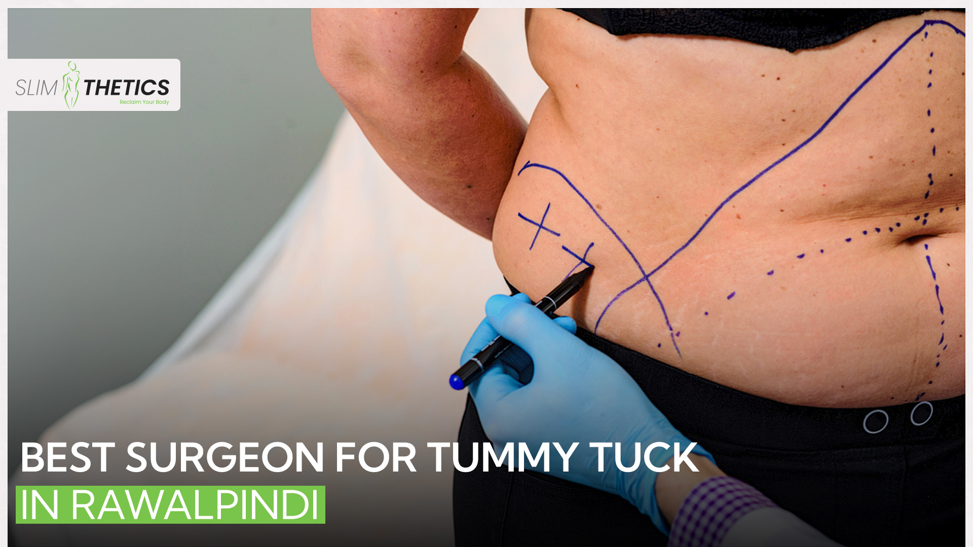 tummy tuck surgeon