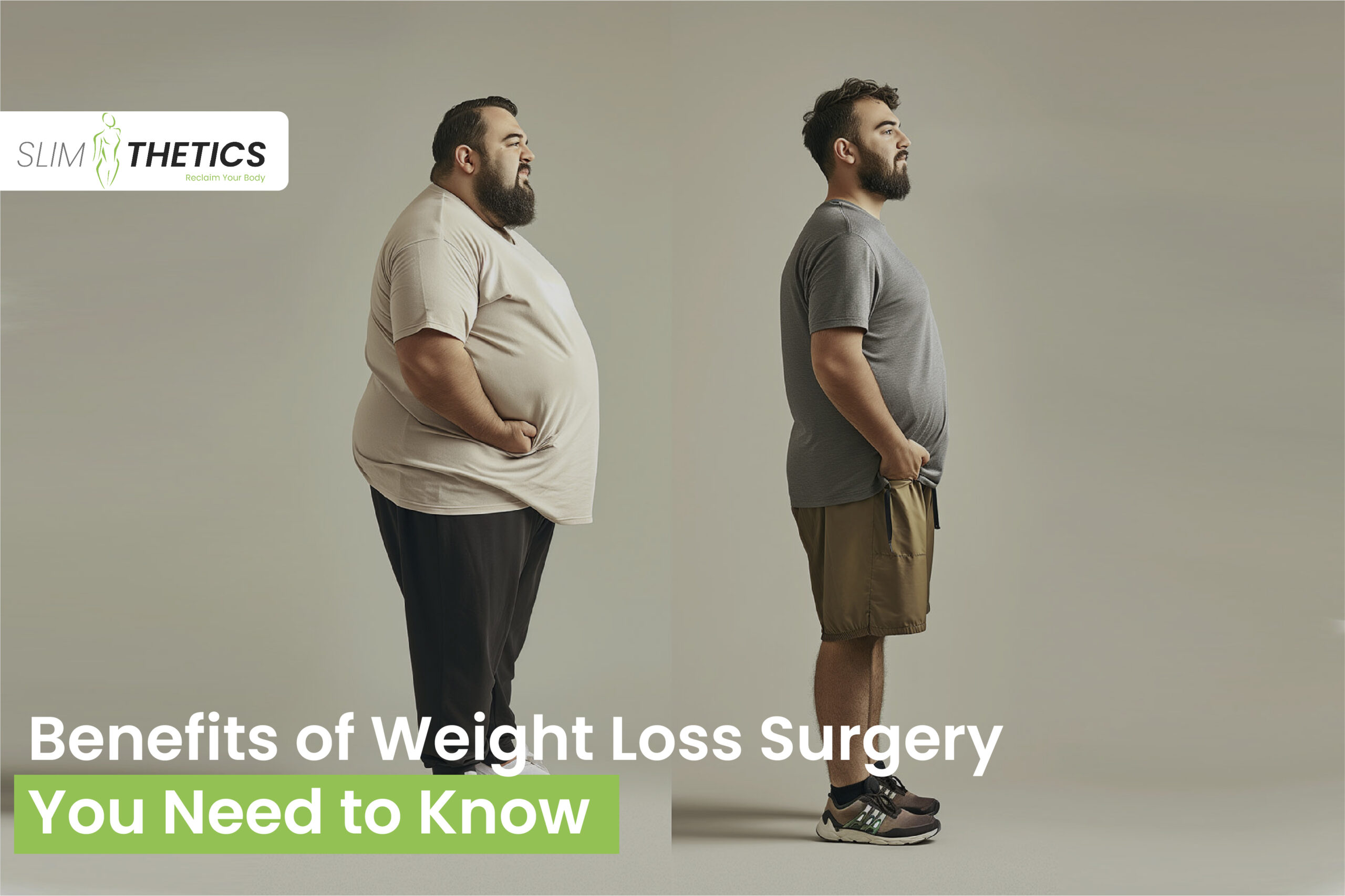 Weight loss surgery