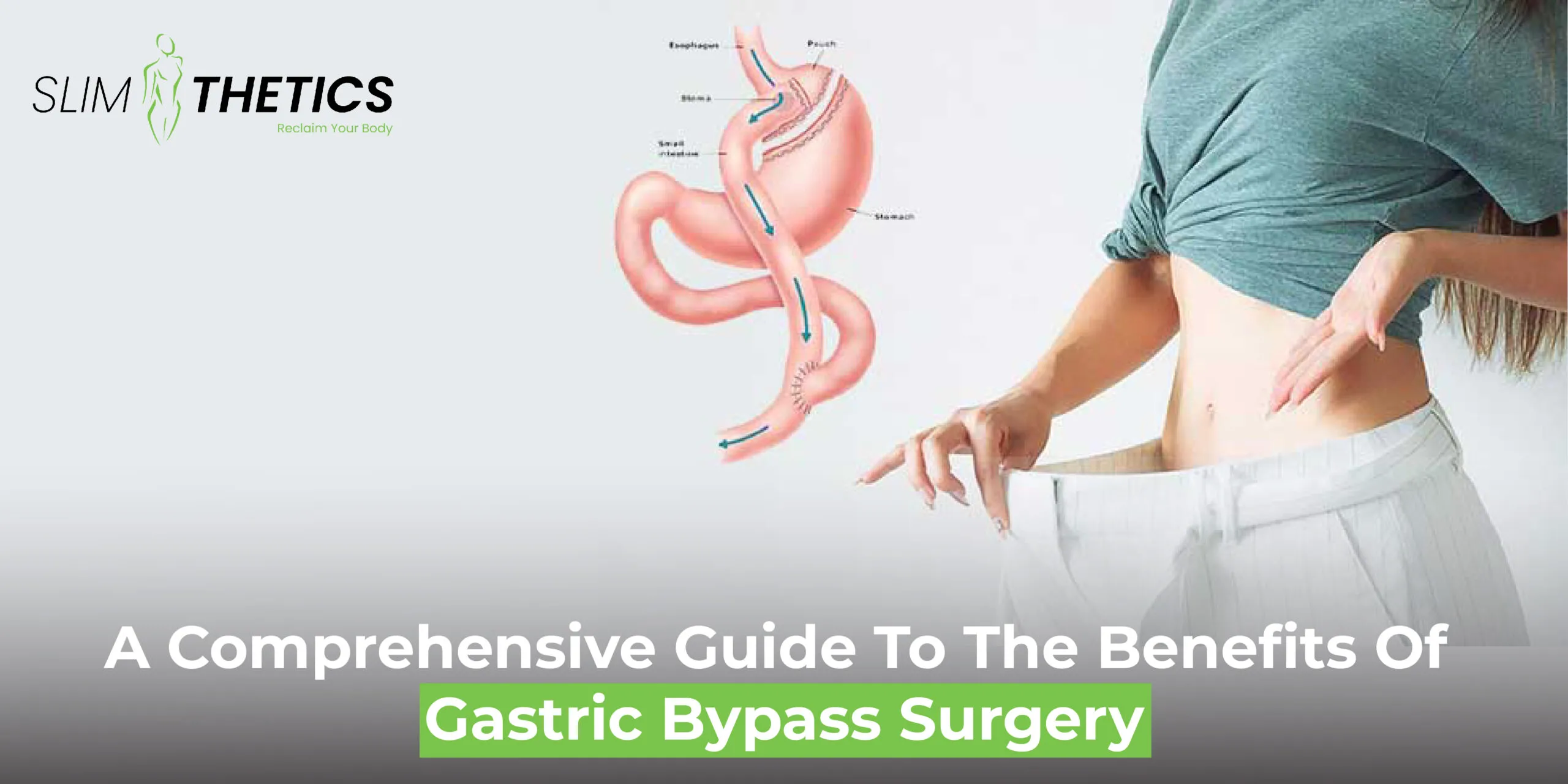 A Comprehensive Guide to the Benefits of Gastric Bypass Surgery
