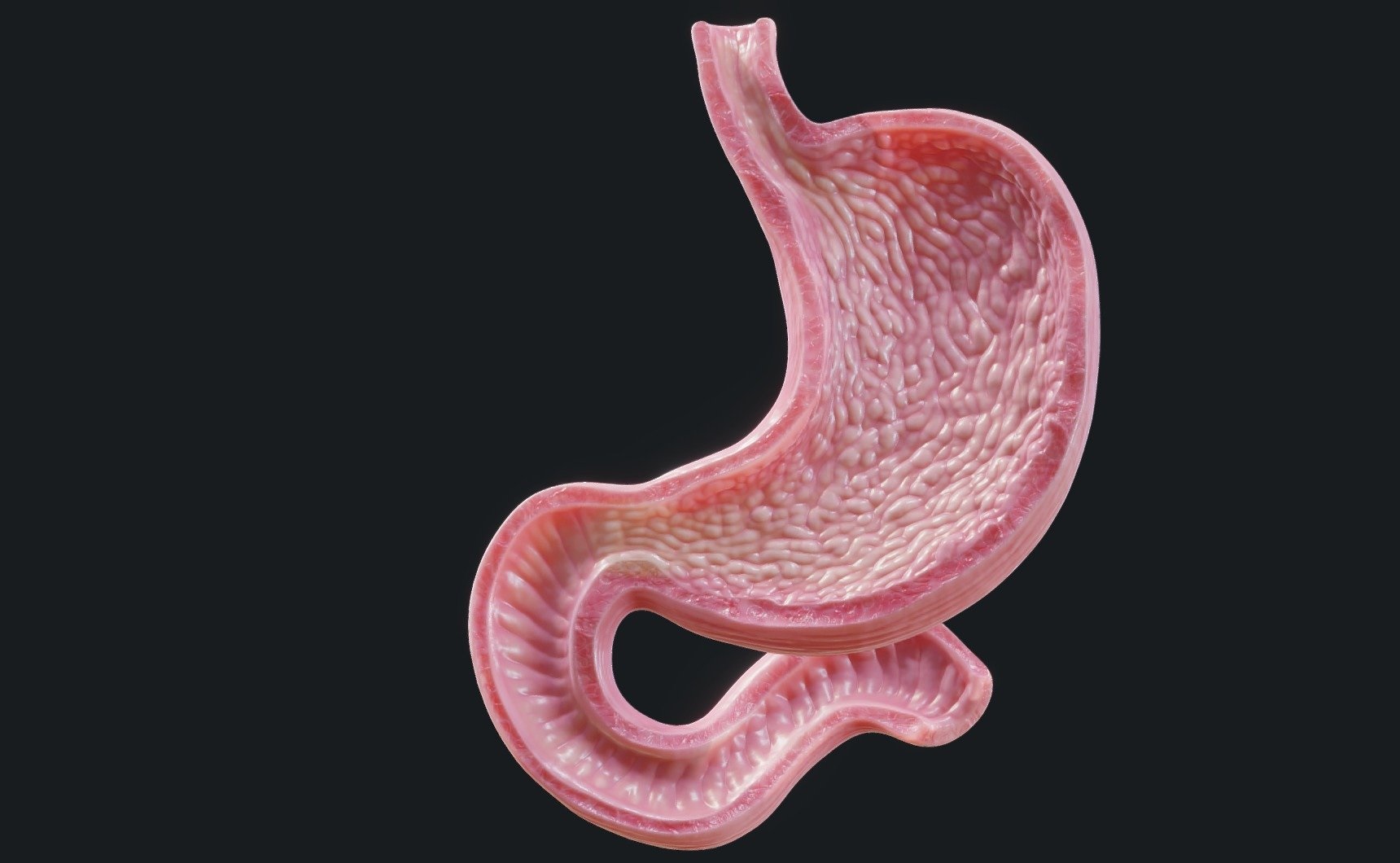 Can your stomach grow after bariatric surgery