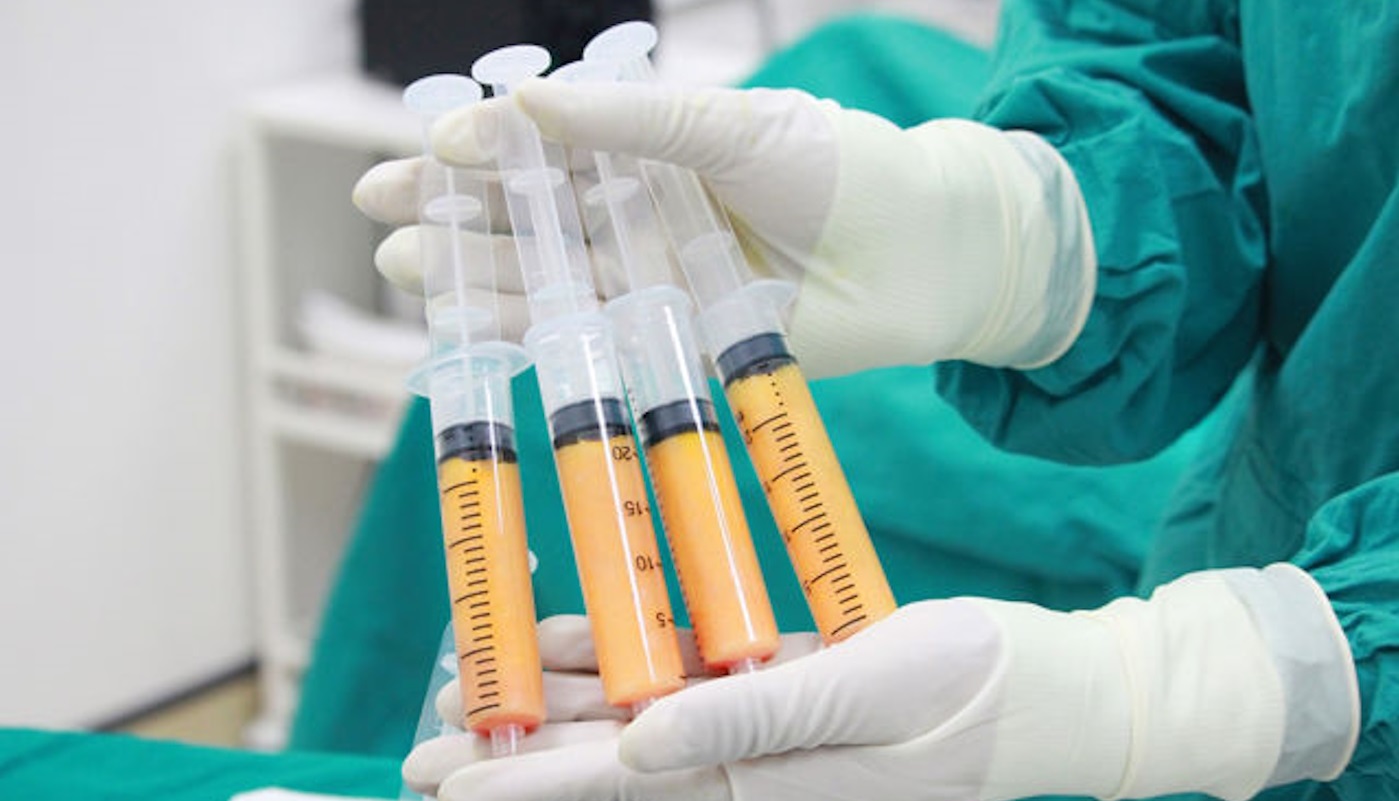 Nano Fat Grafting in Islamabad