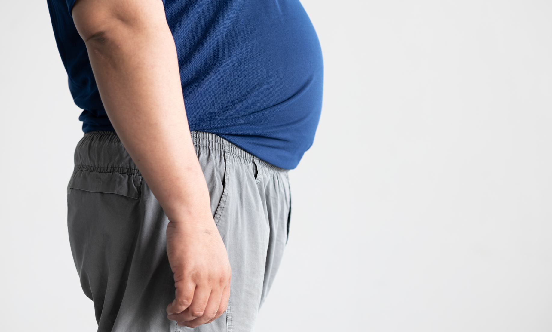 What To Expect After 1 Month of Liposuction