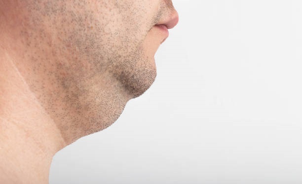 Are fat-dissolving injections safe for double chin fat?