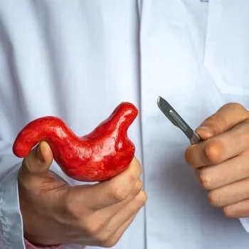 Bariatric Surgery