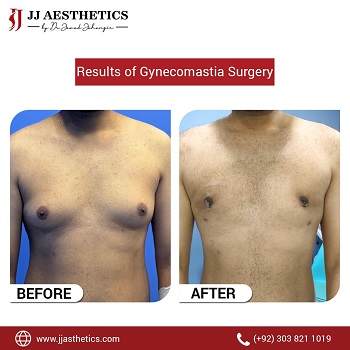 Cosmetic Surgery in Islamabad Best Dermatologist Surgeon