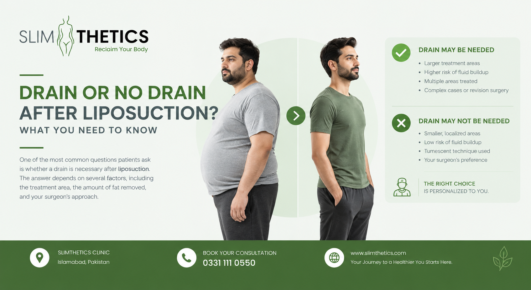 Drain or no drain after liposuction