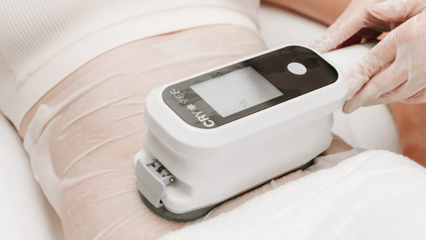 How many sessions of cryolipolysis are needed to get results?