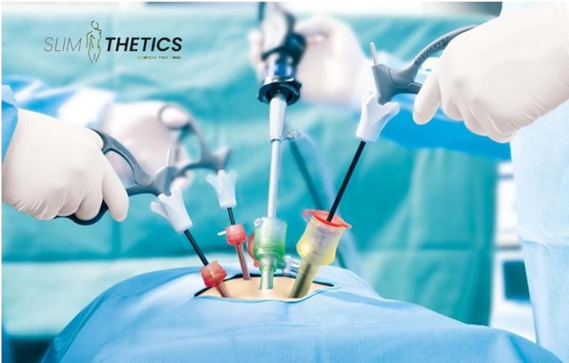 Laparoscopic Surgery in Islamabad
