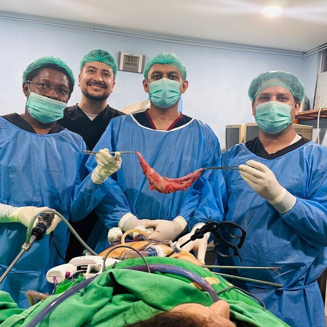 Sleeve Gastrectomy