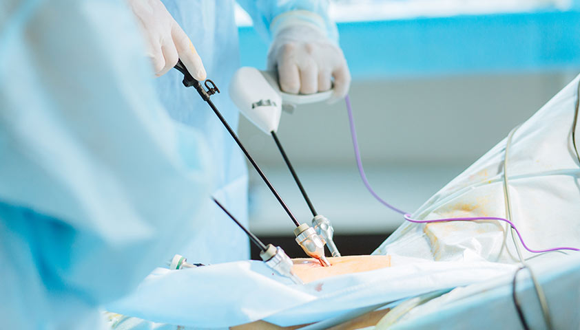What conditions require laparoscopy?