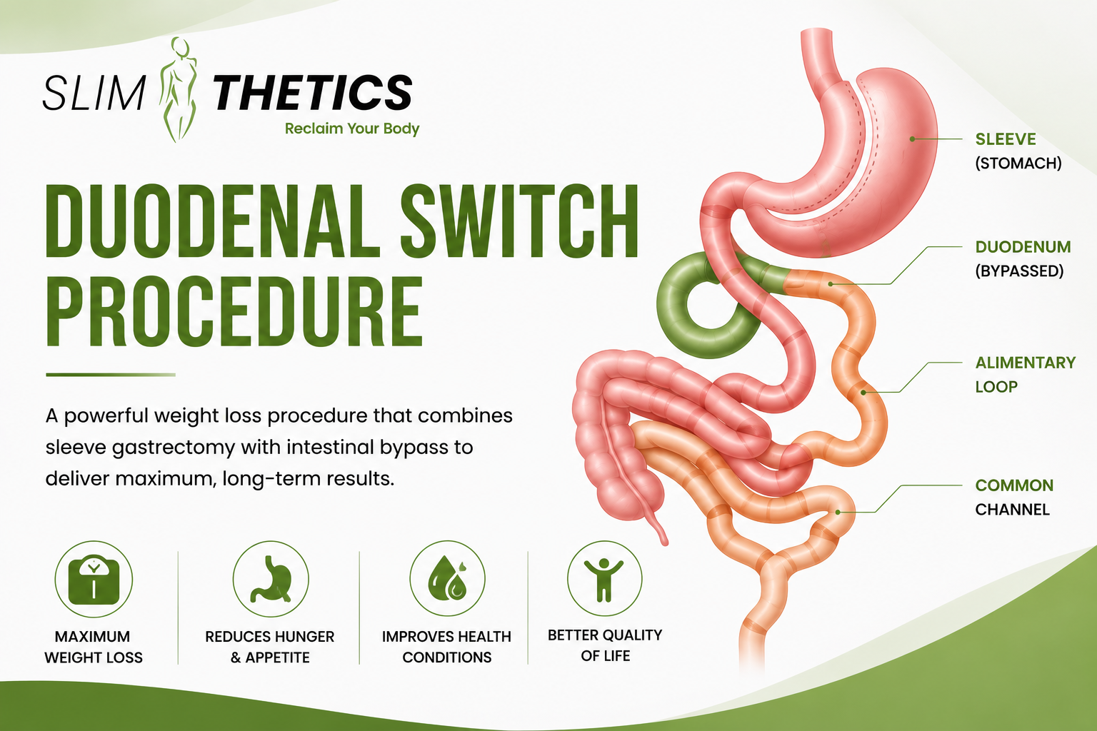 Duodenal-Switch-Procedure-in-Islamabad