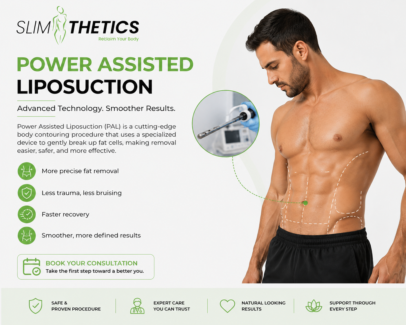Power Assisted Liposuction in Islamabad Rawalpindi