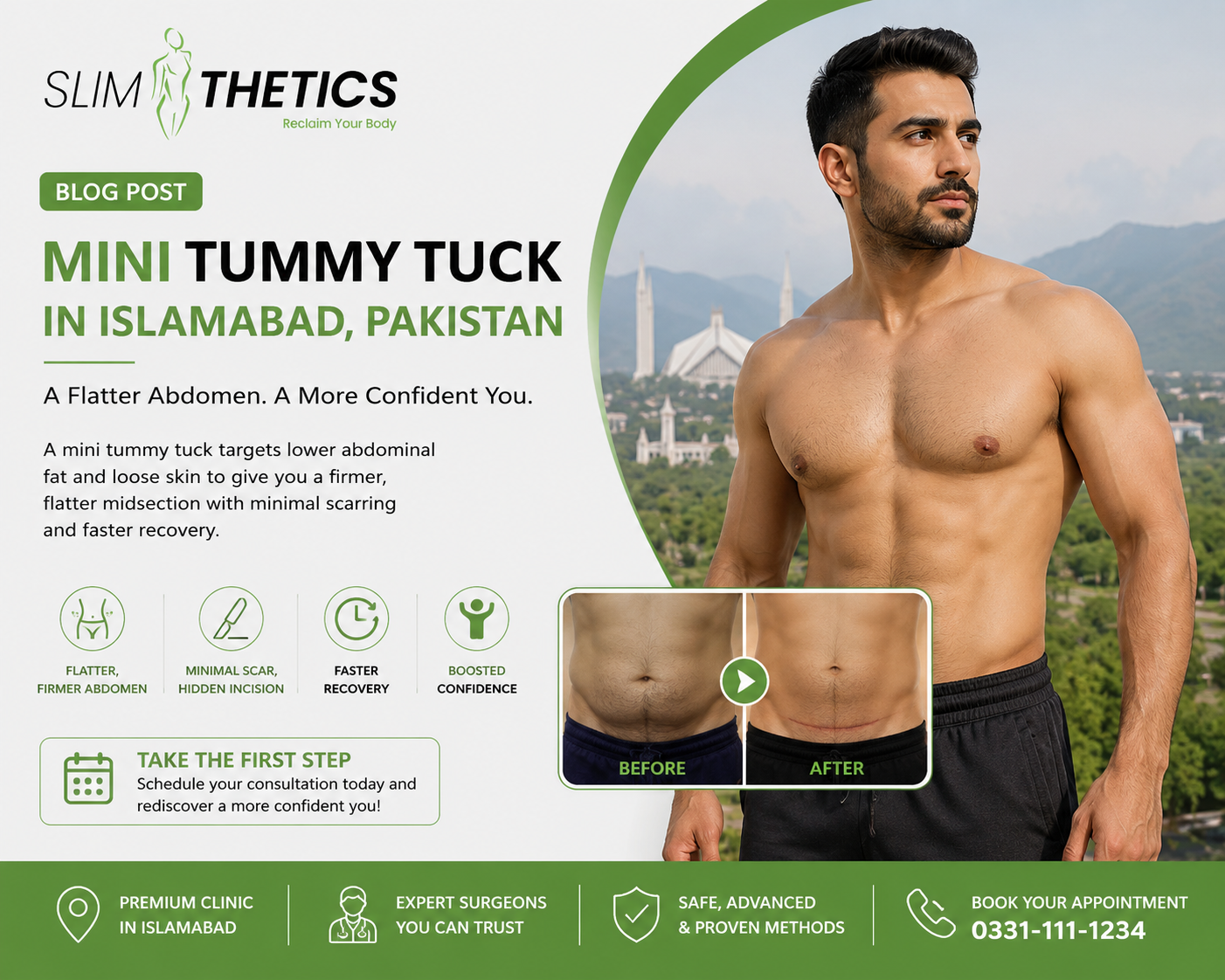 mini tummy tuck in Islamabad pakistan