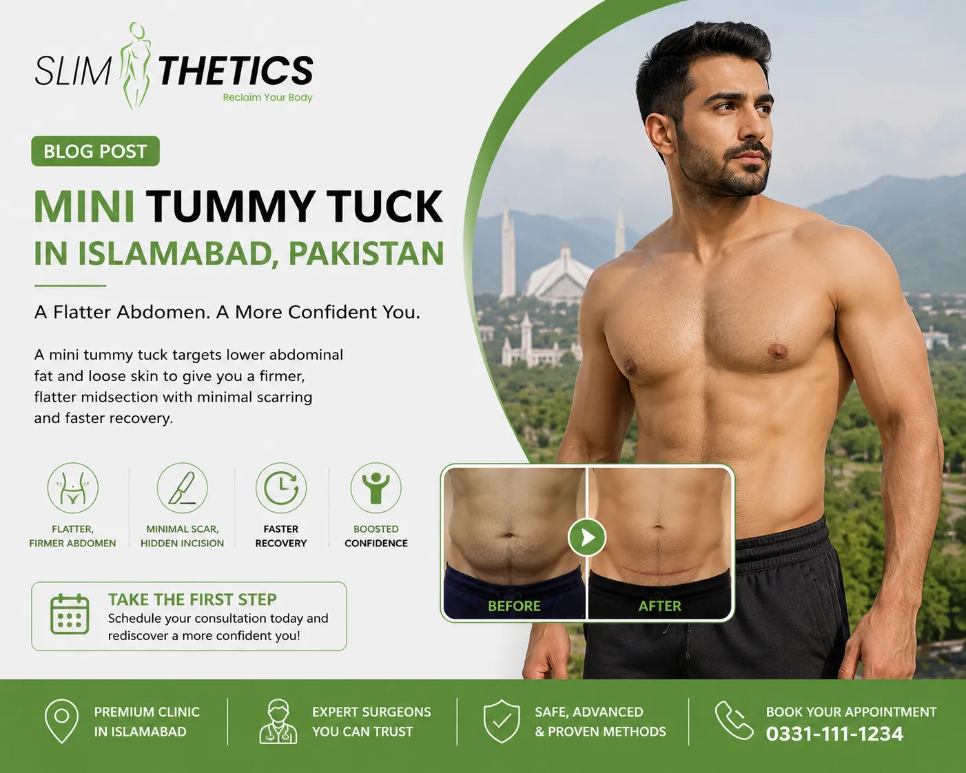 mini tummy tuck in Islamabad pakistan