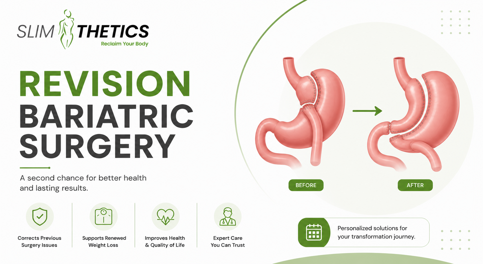 revision bariatric surgery in Islamabad