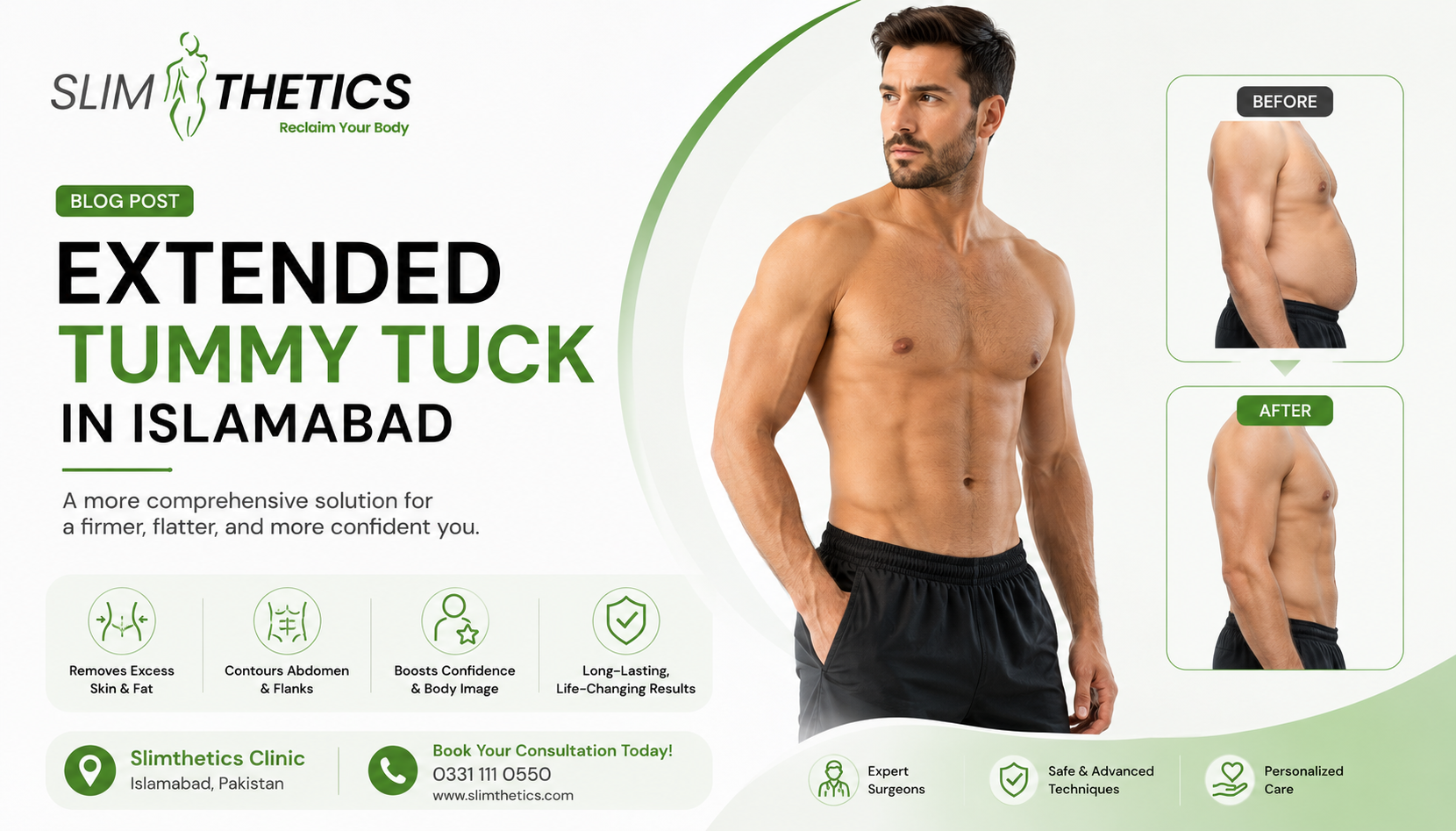 Extended Tummy Tuck in Islamabad