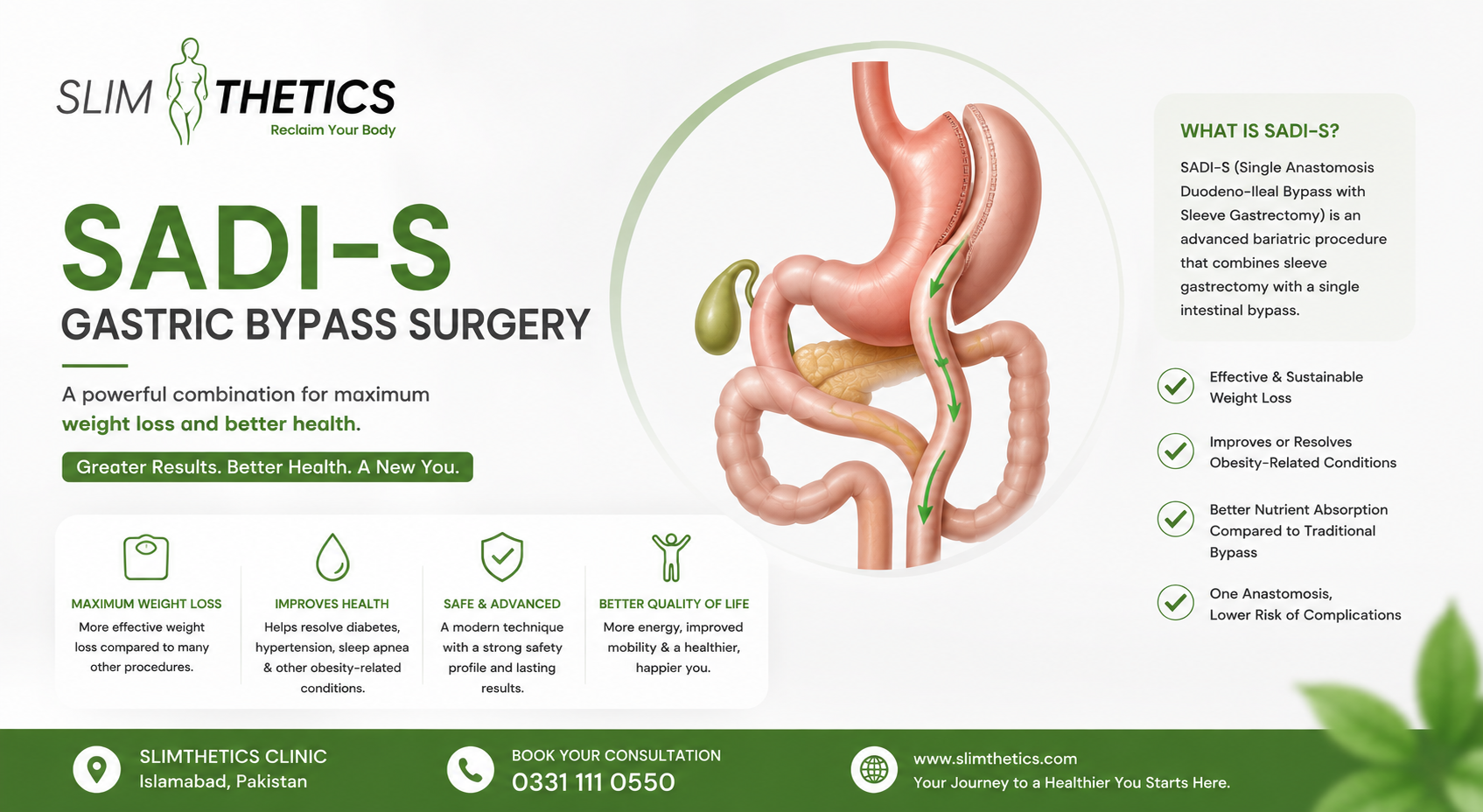 sadi-s gastric bypass surgery in Islamabad