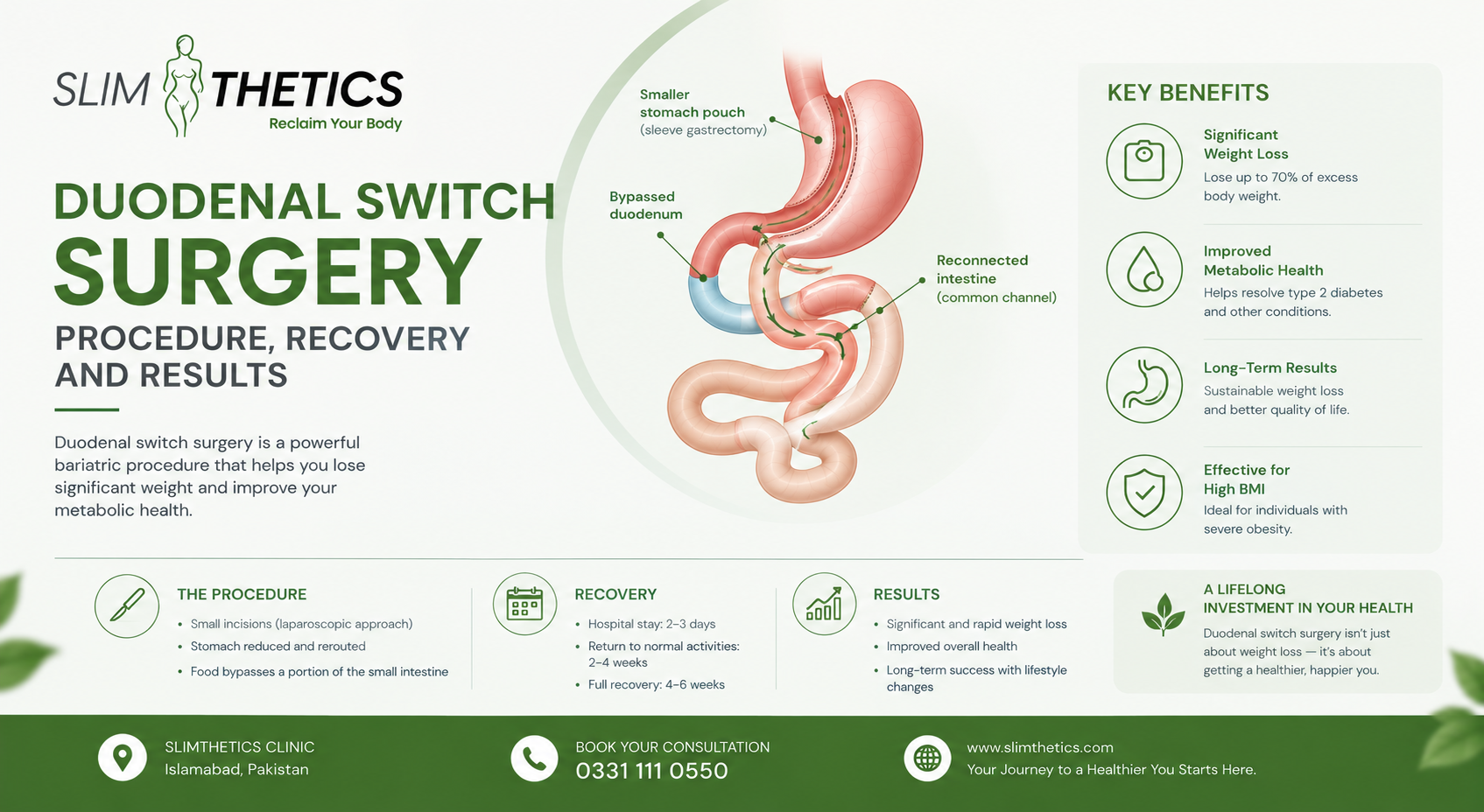 Duodenal Switch Surgery Procedure Recovery and Results