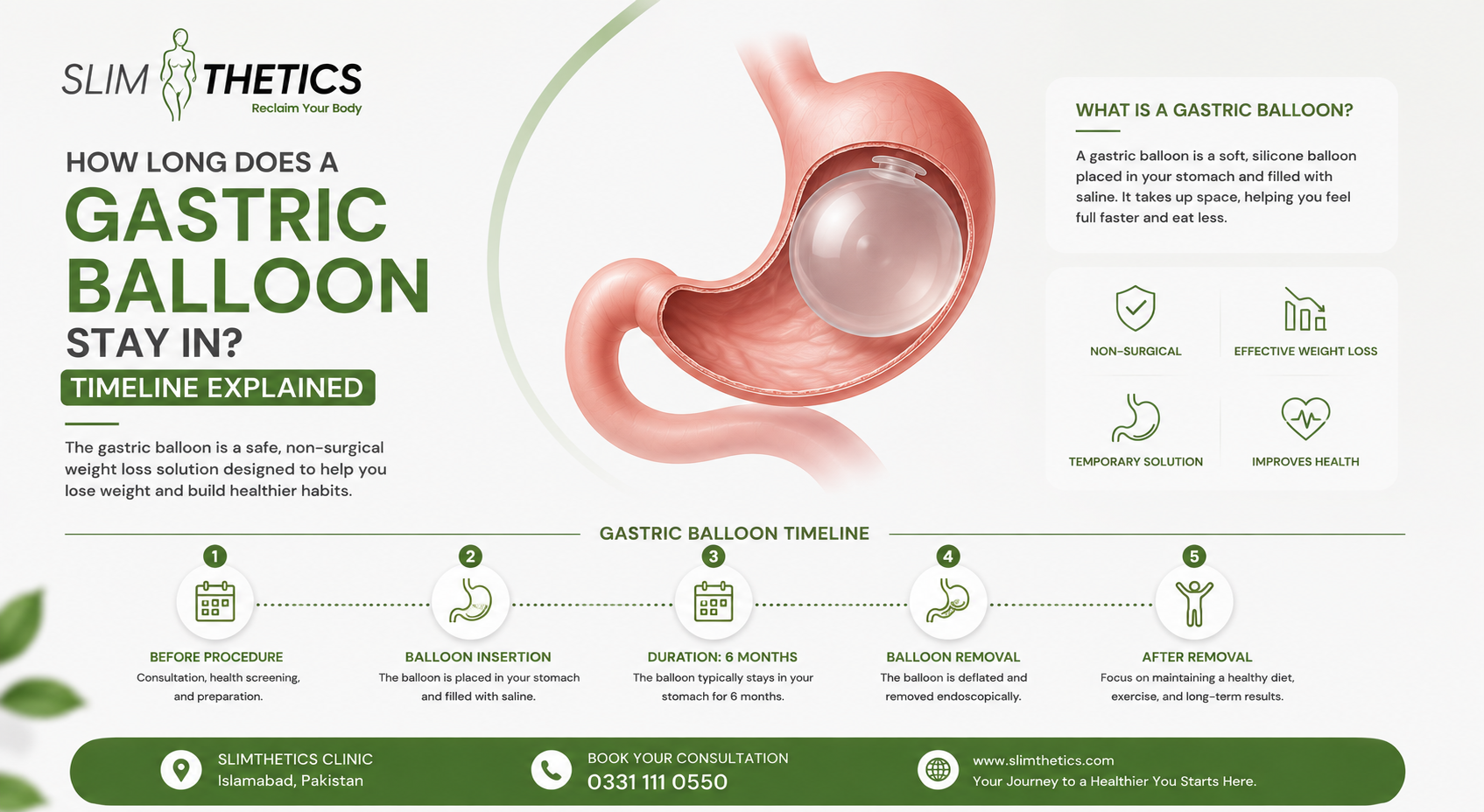 How Long Does a Gastric Balloon Stay In Timeline Explained