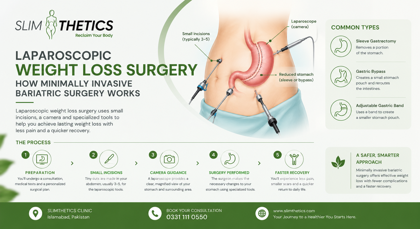Laparoscopic Weight Loss Surgery : How Minimally Invasive Bariatric Surgery Works
