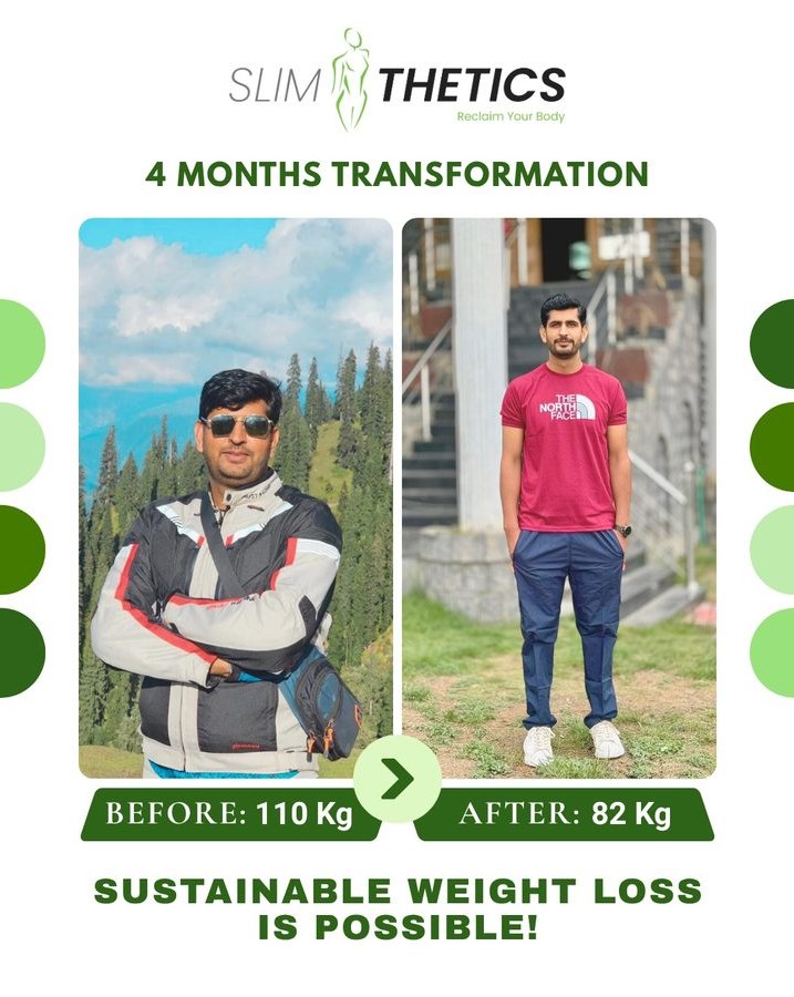 Before and after weight loss transformation at Slimthetics 2