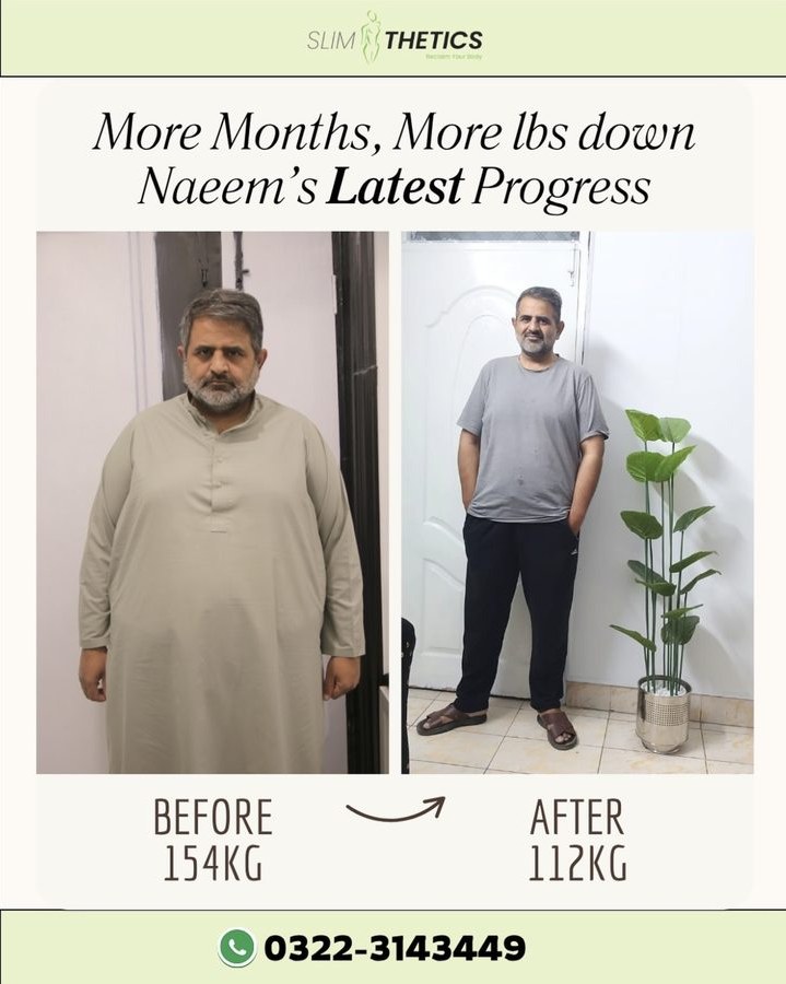 Before and after weight loss transformation at Slimthetics 4